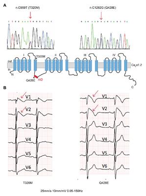 Peptide-Based Targeting of the L-Type Calcium Channel Corrects the Loss-of-Function Phenotype of Two Novel Mutations of the CACNA1 Gene Associated With Brugada Syndrome